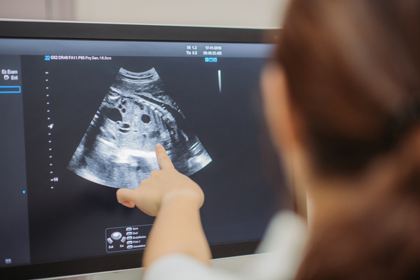 Provider pointing at an ultrasound of a fetus